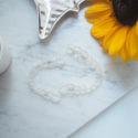 invisalign – Update